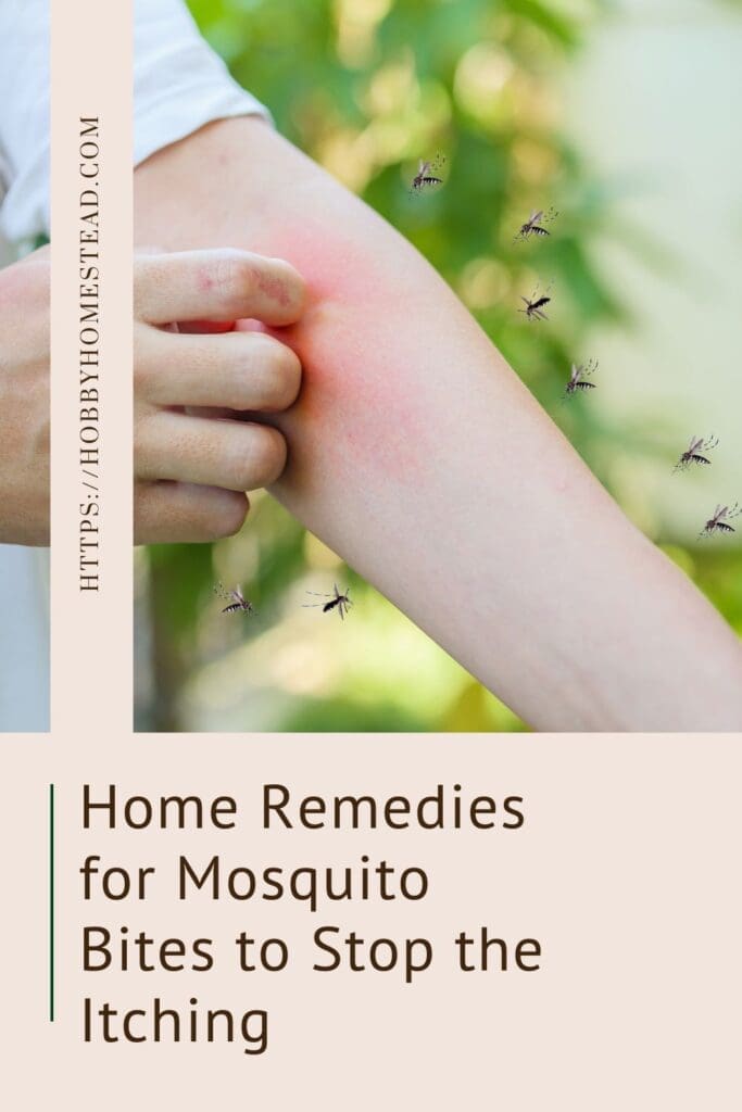 Home Remedies for Mosquito Bites to Stop the Itching